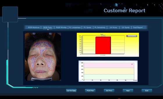 3D Facial Skin Testing Machine Skin Pore, Wrinkle, Spots, Acne Analysis Device