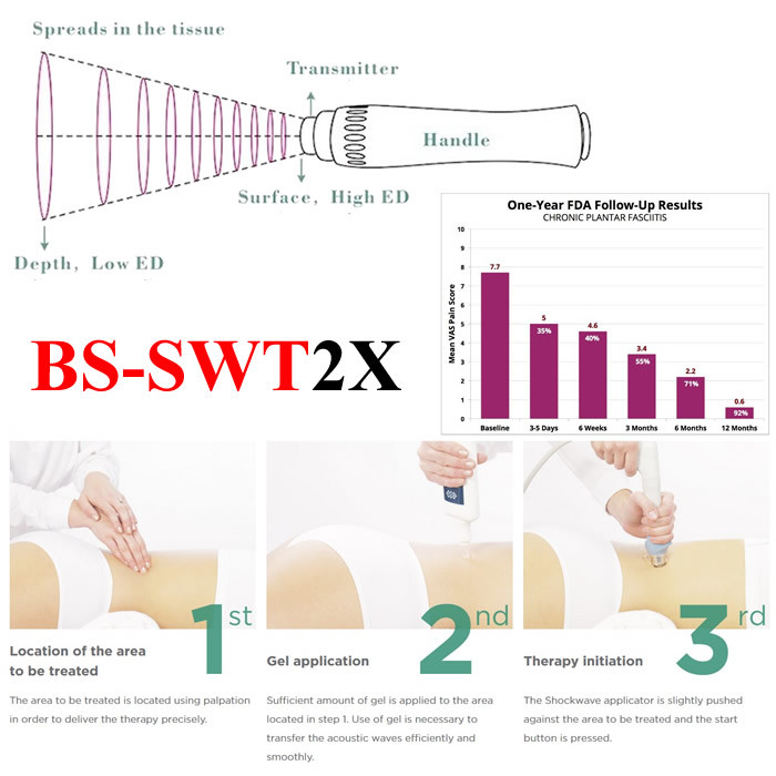 Physiotherapy Pain Relief ESWT Shockwave Therapy Machine For Soft