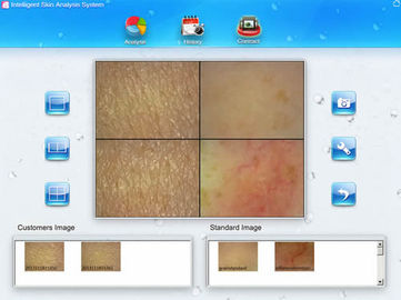 Mini Facial Skin Analysis Machine Beauty Device 7200K USB Interface For Home
