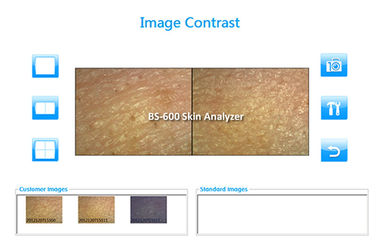 Mini Facial Skin Analysis Machine Beauty Device 7200K USB Interface For Home