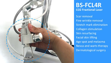 CO2 Laser Fractional Skin Resurfacing Treatment