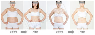 Lipo Massage Ultrasonic Cavitation Body Slimming Machine For Body Shaping / Weight Loss