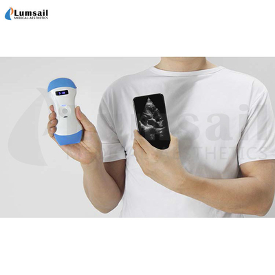 Linear Convex Phased Array 3 In 1 Handheld Pocket Ultrasound Scanner With APP