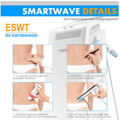 Achillodynia / Plantar Fasciitis ESWT Shockwave Therapy Machine ESWT