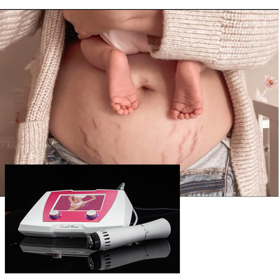 Cellulite Treatment Acoustic Shockwave Therapy Device Shock Wave Cellulite Massage Machine