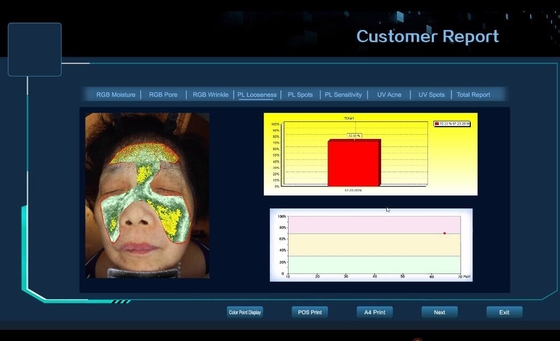 6 Spectrum Professional Skin Analyzer Facial Analysis / Skin Analyser / Skin Analyzer 3D