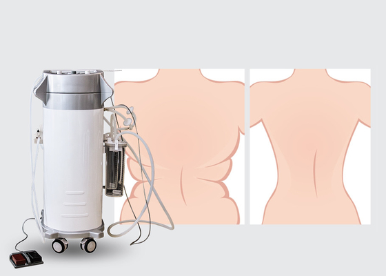 Low Noise Body Shaped Power Assisted Liposuction Equipment For Hospital