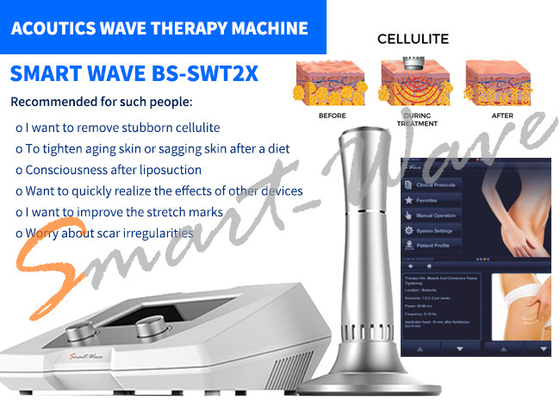 Beauty Salon BS-SWT2X Acoustic Wave Therapy Machine Cellulite Removal 1 Year Warranty