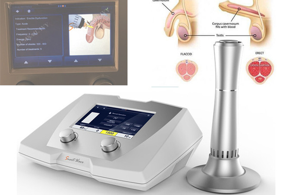 Low Intensity Shockwave Therapy (Lieswt) Ed Shock Wave Therapy Equipment With Professional Pre-Set Protocols