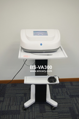 Non Invasive 30MHz Vascular Age Spot Removal Machine