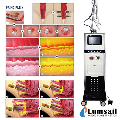 Vaginal Tightening Co2 Fractional Laser Machine 40w