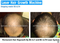 High End Laser Light Therapy For Hair Loss , Hair Growth Laser Treatment