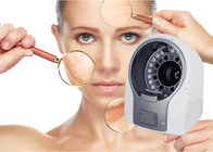 RGB Visible Light 3D Skin Analyzing Machine 3: 4 Preview System For Wrinkle Analysis