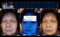 8800 Illumination Skin Age Test Machine / Face Care Machine With RGB Light ISO9001