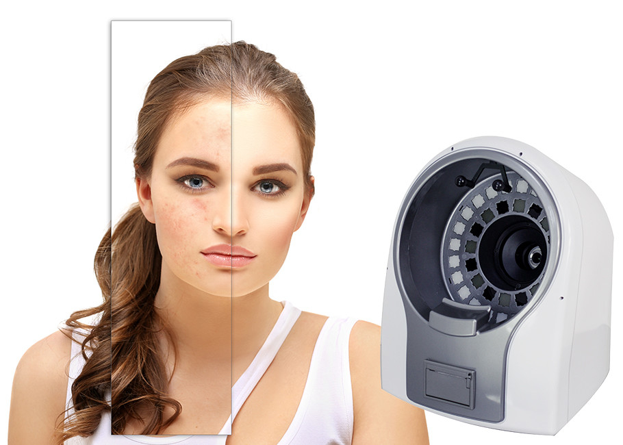 6x Optical Lens Lumsail 3D Complexion Skin Analysis Equipment
