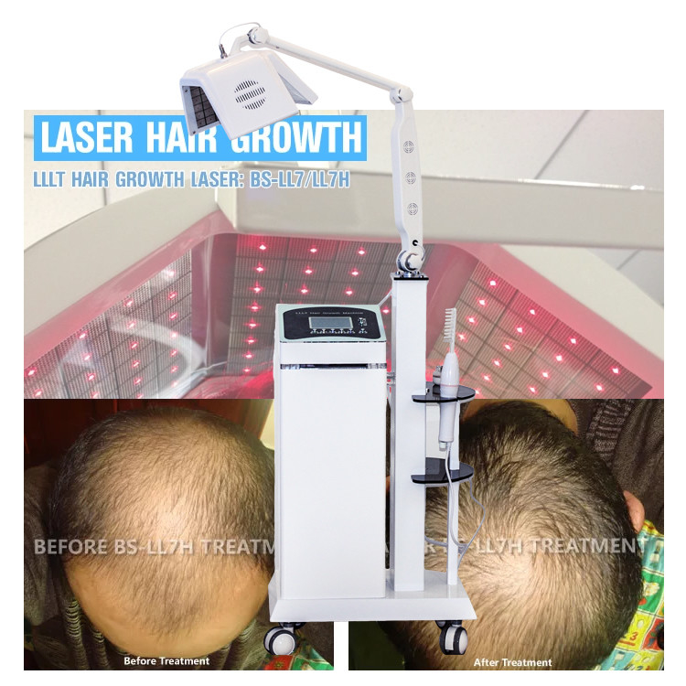 Safe Laser Hair Regrowth Device Energy Adjustable Handheld Probe Non Invasive Treatment
