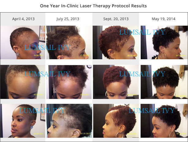 Diode Laser Hair Regrowth Device Handheld Probe Hair Growing Machine For Hair Salon