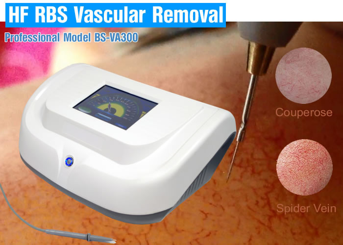 Portable 30MHZ High Frequency Vascular Removal Machine For Sun Spots Treatment