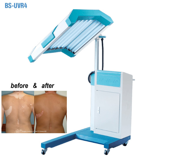 Phototherapy Treatment UVB Light Therapy Machine , UVB Narrow Band Light Therapy