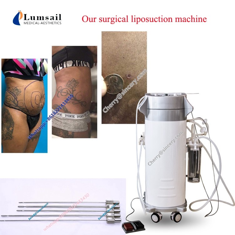 Fat Removal Surgical Liposuction Machine Weight Loss Cavitation Vacuum Liposuction
