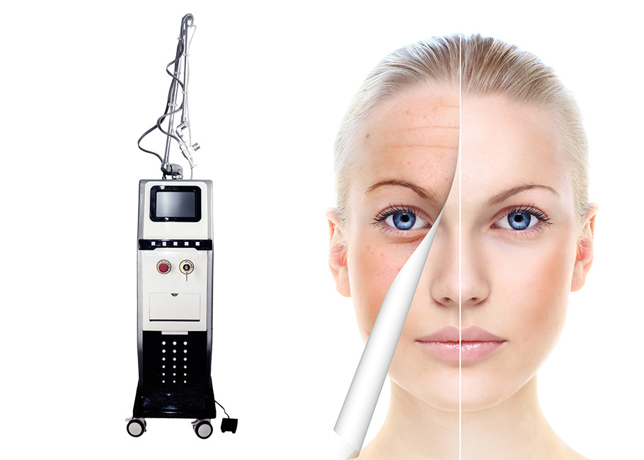 Fractional Co2 Laser For Acne Scars