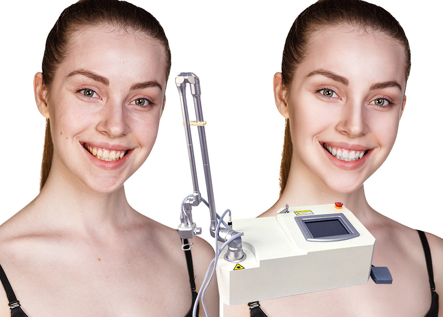 Intelligent Acne Scar Removal Machine Laser Resurfacing Machine 12mm