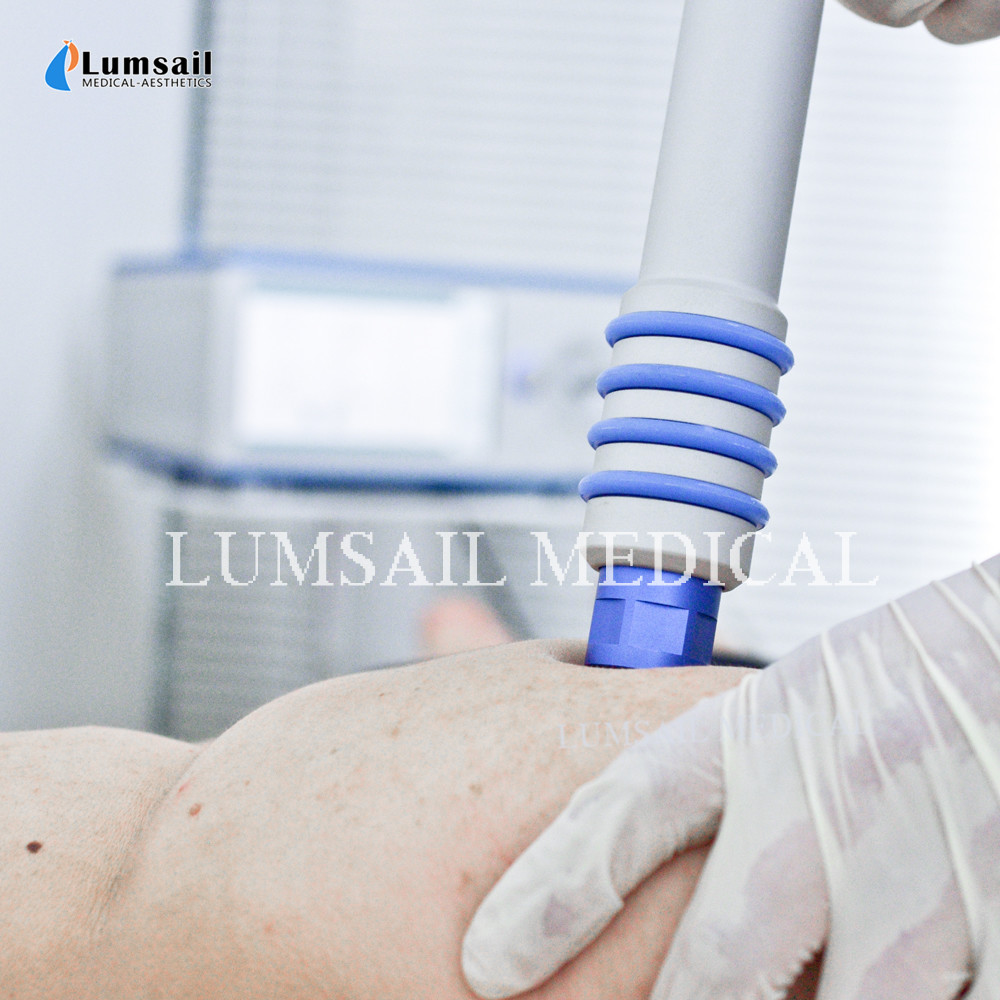 AWT Acoustic Wave Therapy Machine For Effective Cellulite Treatment OEM ODM