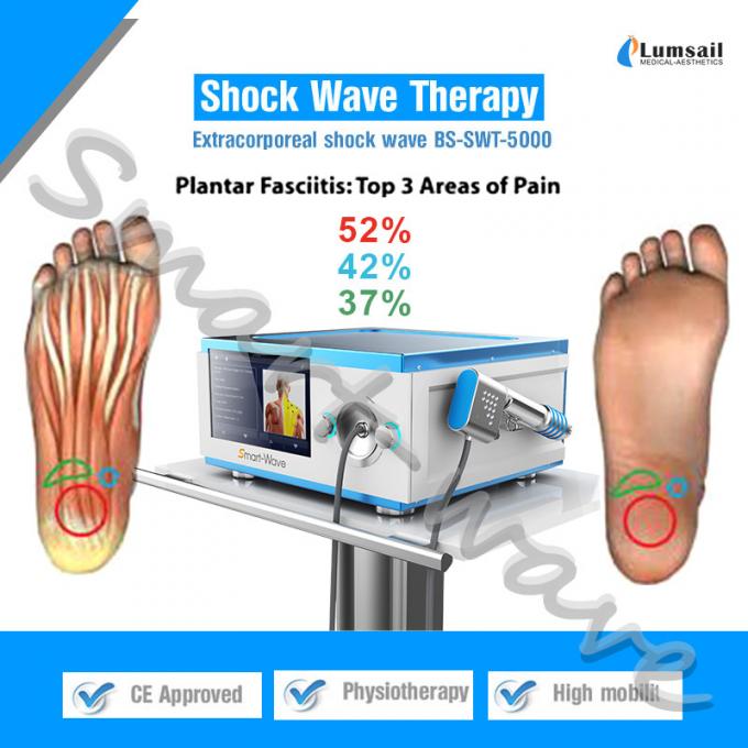 Extracorporeal Shock Wave Therapy Plantar Fasciitis