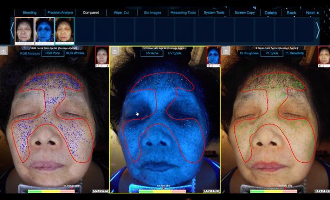 Spectrum Skin Test 6 Spectrum See More Clear Skin Problem Facial Skin Analysis Equipment