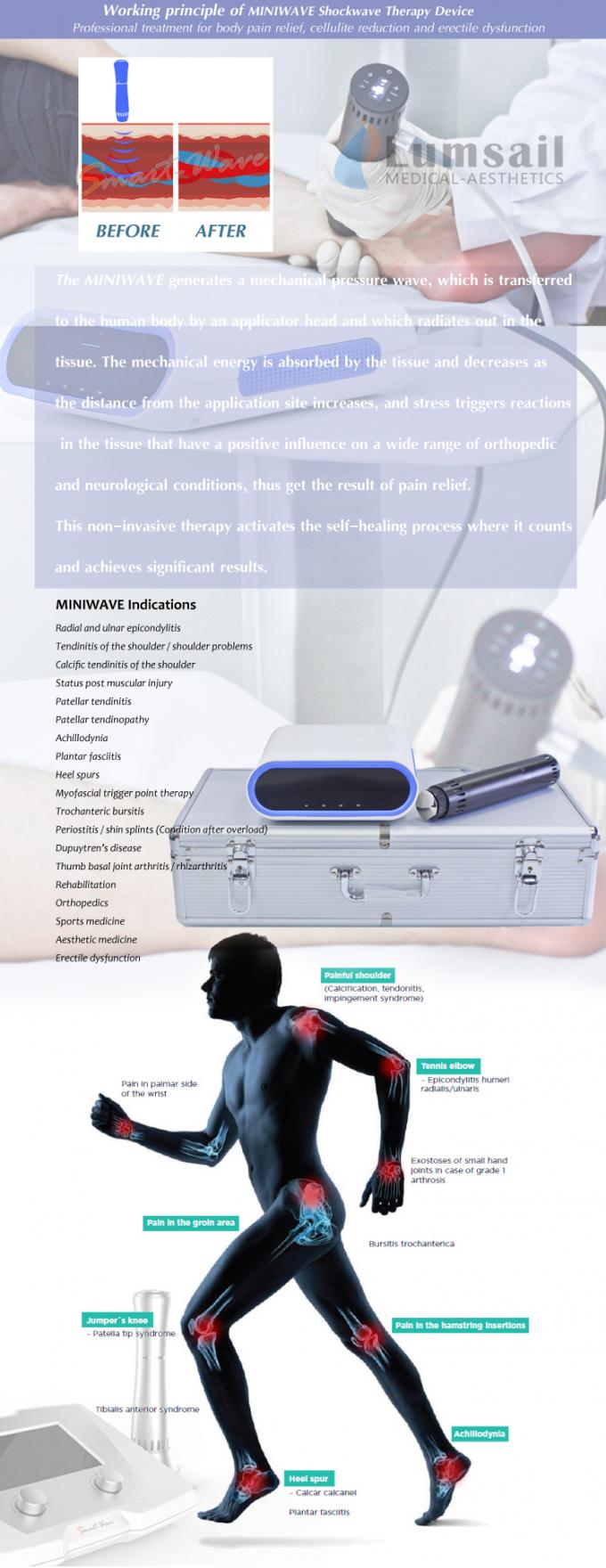 Plantar Fasciitis ESWT Shockwave Therapy Machine Foot Pain Treatment