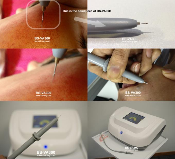 Professional Vascular Removal Machine , Spider Vein Removal Machine High Frequency
